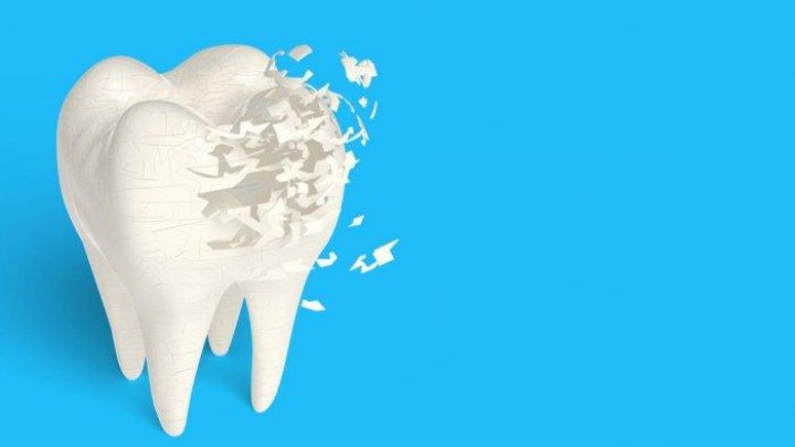 5 Makanan dan Minuman Penyebab Gigi Cepat Keropos, Apa Saja?